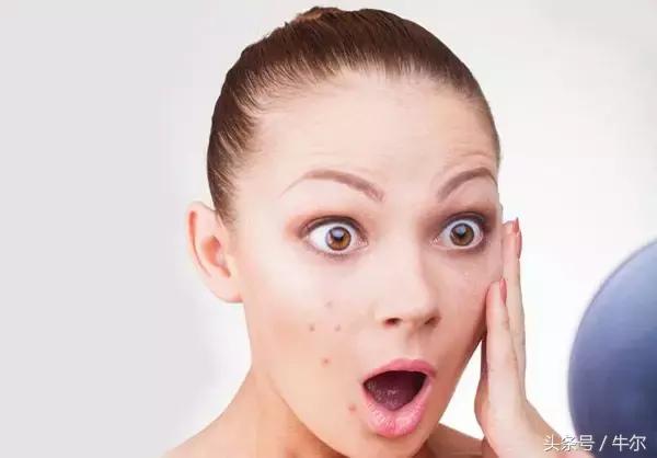 成年了还长痘咋治,50岁的女人脸上还长痘是什么原因