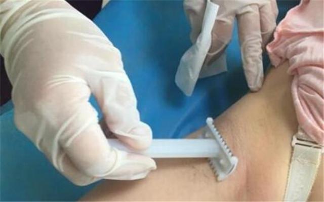 内检和备皮孕妈最害怕男医生，这是为什么呢？