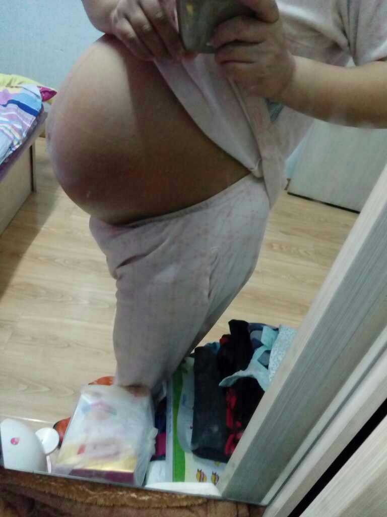 传好孕，顺产男宝，附症状，附B超