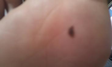 科普警惕人体易癌变的9大部位,为什么越来越多人癌变