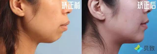 医生郭涛,正畸郭涛