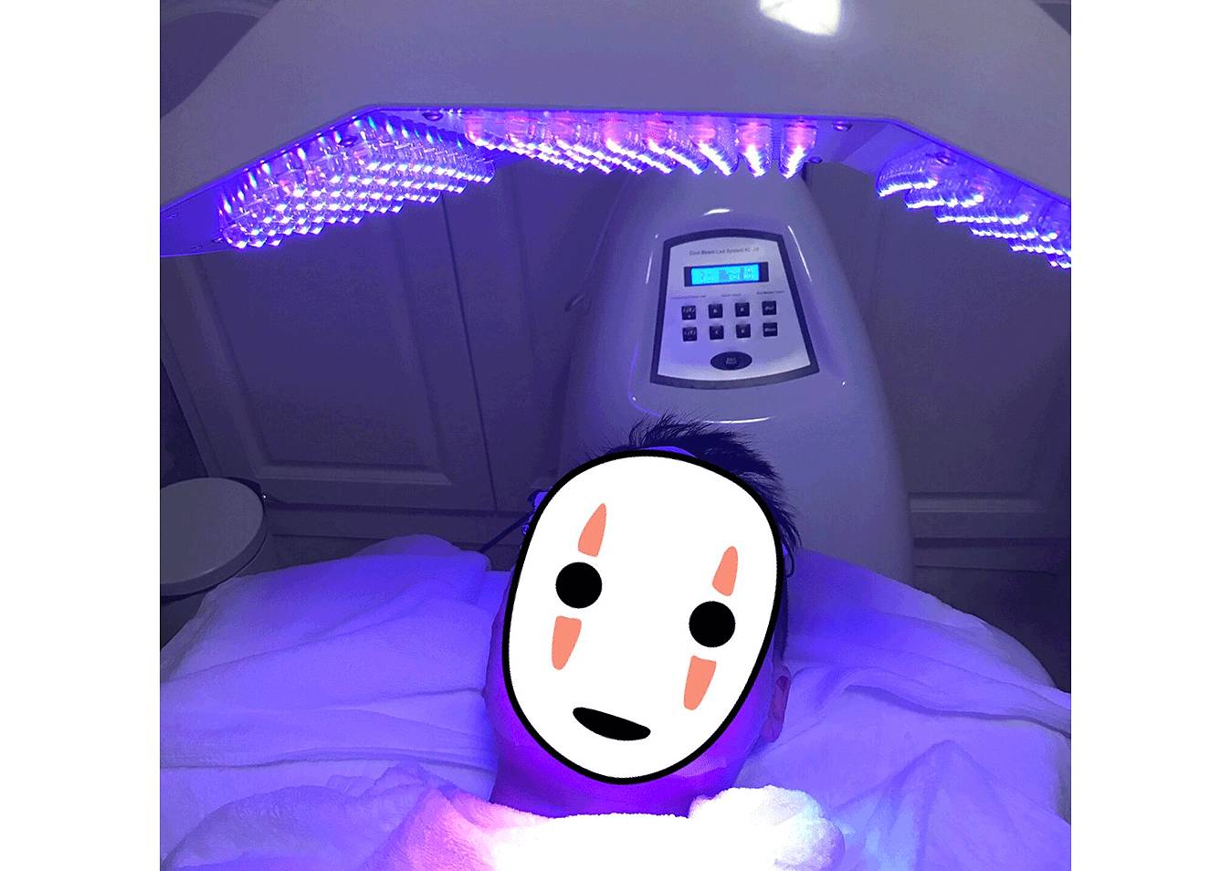 我的祛斑血泪史完整版,我的祛痘史