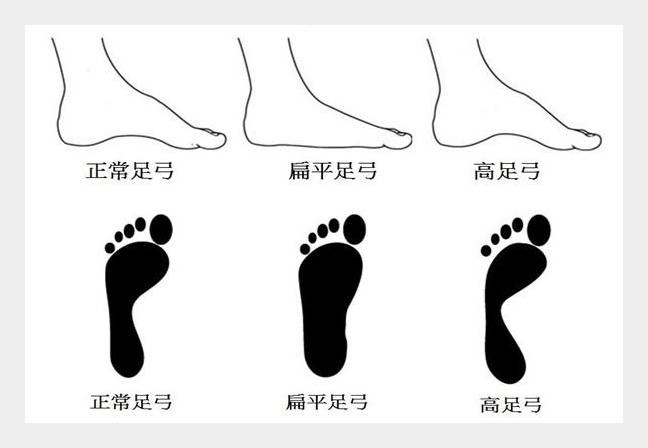 适合自己的脚的鞋才是最好的鞋,怎么挑选一双不磨脚的鞋