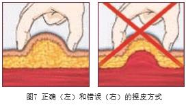 打针四种手法,什么手法打针不疼