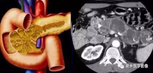18种疾病包括哪些,18种肿瘤有哪些