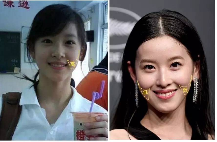 泪沟法令纹颈纹显老怎么办,改善泪沟法令纹全脸提升的方法