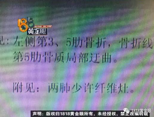 杭州1女子中医馆做推拿肋骨断3根医生没有资格证