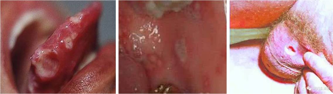 爸妈说你“二天”一定要得的这种病，到底是个啥子病？