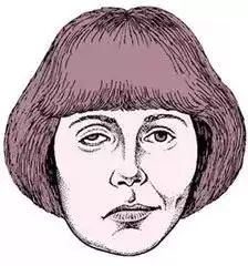 山东老中医治疗面瘫在哪里,濉溪80多岁老中医治面瘫