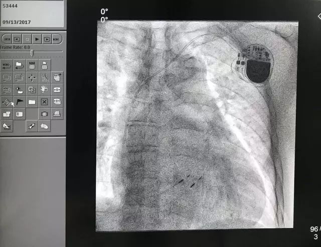 云南博亚医院发生了什么,云南博亚最新消息