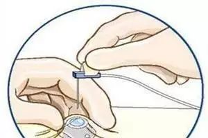 杈撴恫娓澏缈奸拡绫诲瀷,杈撴恫娓澏缈奸拡鍥剧墖