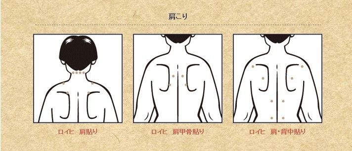 日本止痛药膏有哪些 (日本最常用的止痛膏)