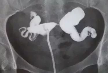 小生命的真实存在,小生命怎么开始的