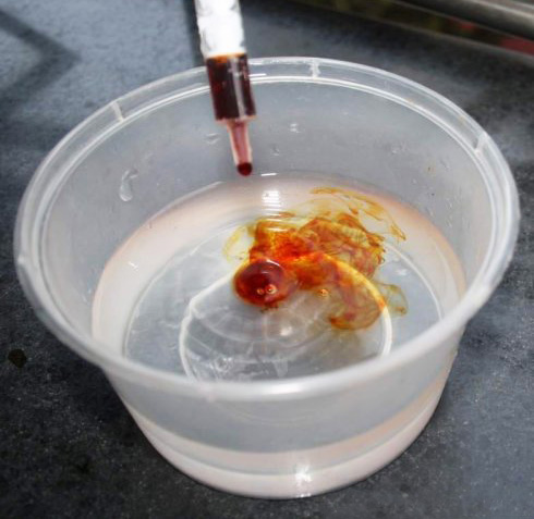 乌龟腐皮老是反复,红茶治疗乌龟腐皮