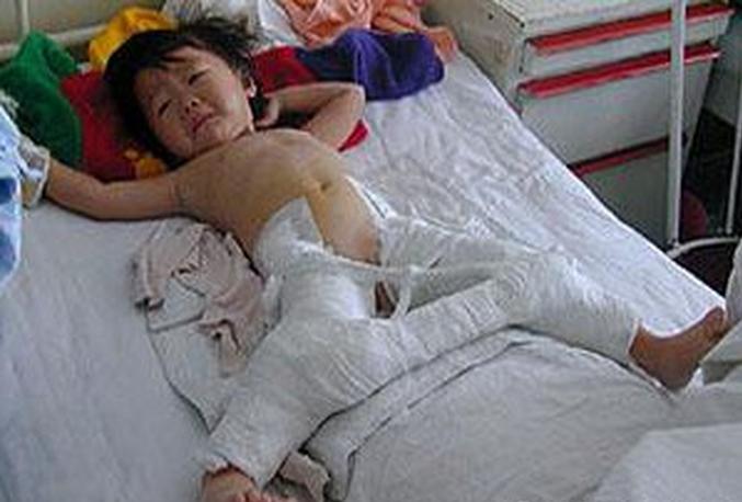 五岁女儿夹紧双腿扭动，检查后妈妈悔不当初，原因居然是平时的穿着问题