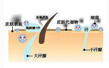 夏天狐臭出汗怎么消除,夏天腋下出汗有异味是狐臭吗