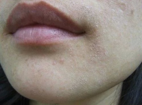 立秋将至怎么护肤,立秋护肤知识大全