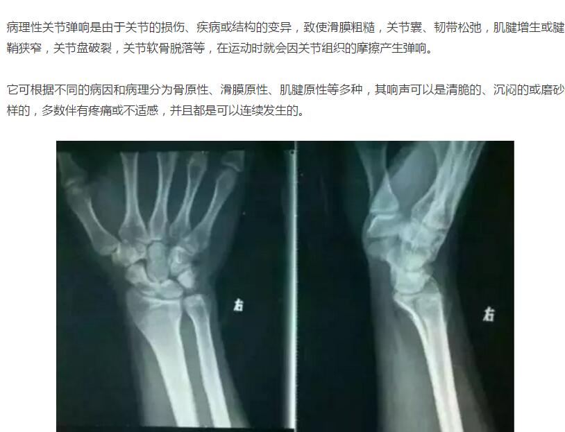 健身关节响怎么训练,健身时关节响什么原因