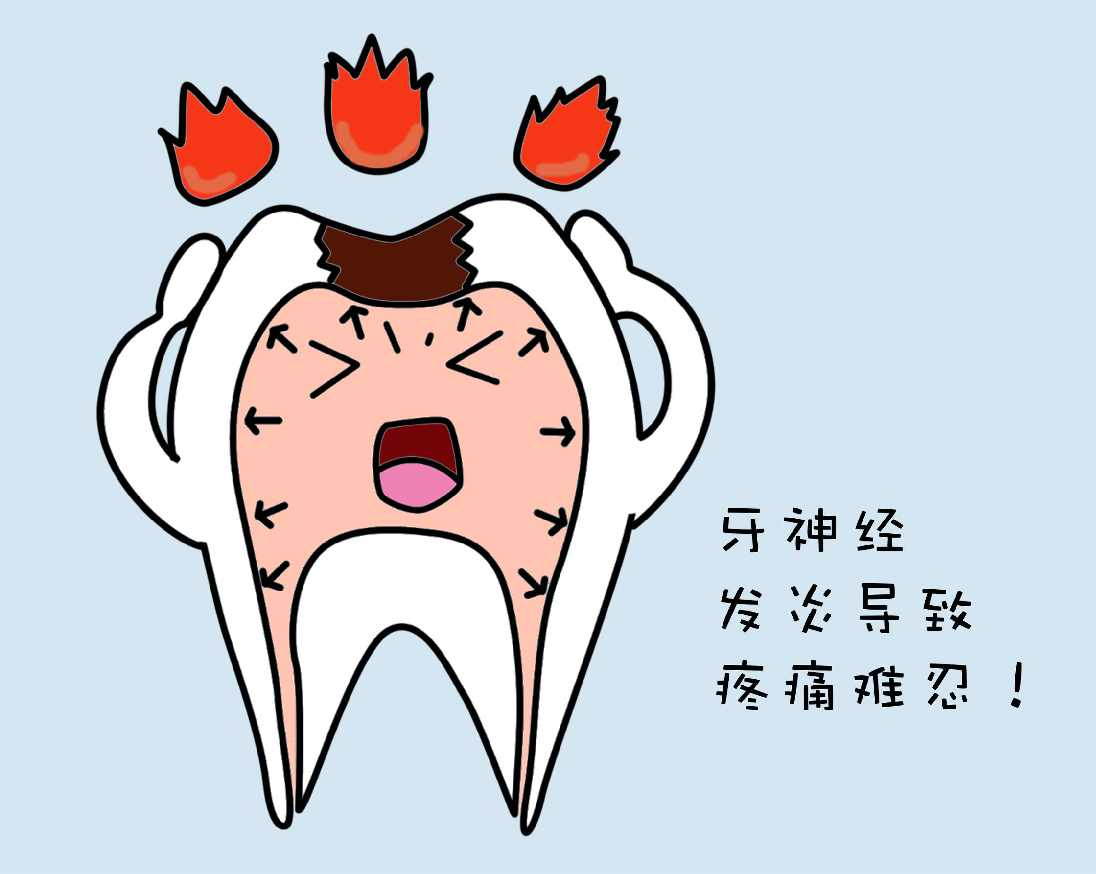 根管治疗是什么作用,根管治疗是什么情况下要做