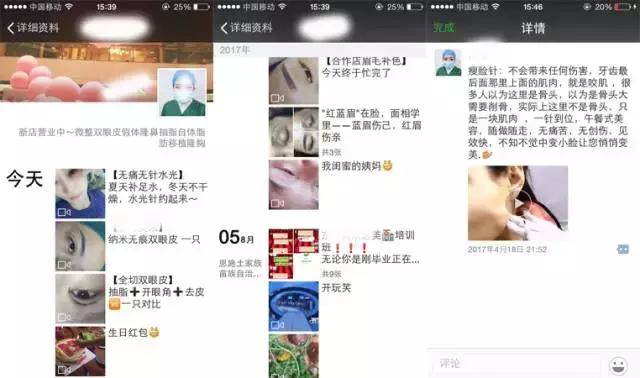 医疗整形赚钱吗,整形行业水太深套路多