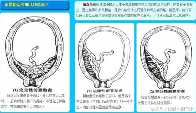 准妈妈必须小心保健误区,准妈妈当心最新孕产妇禁忌必读