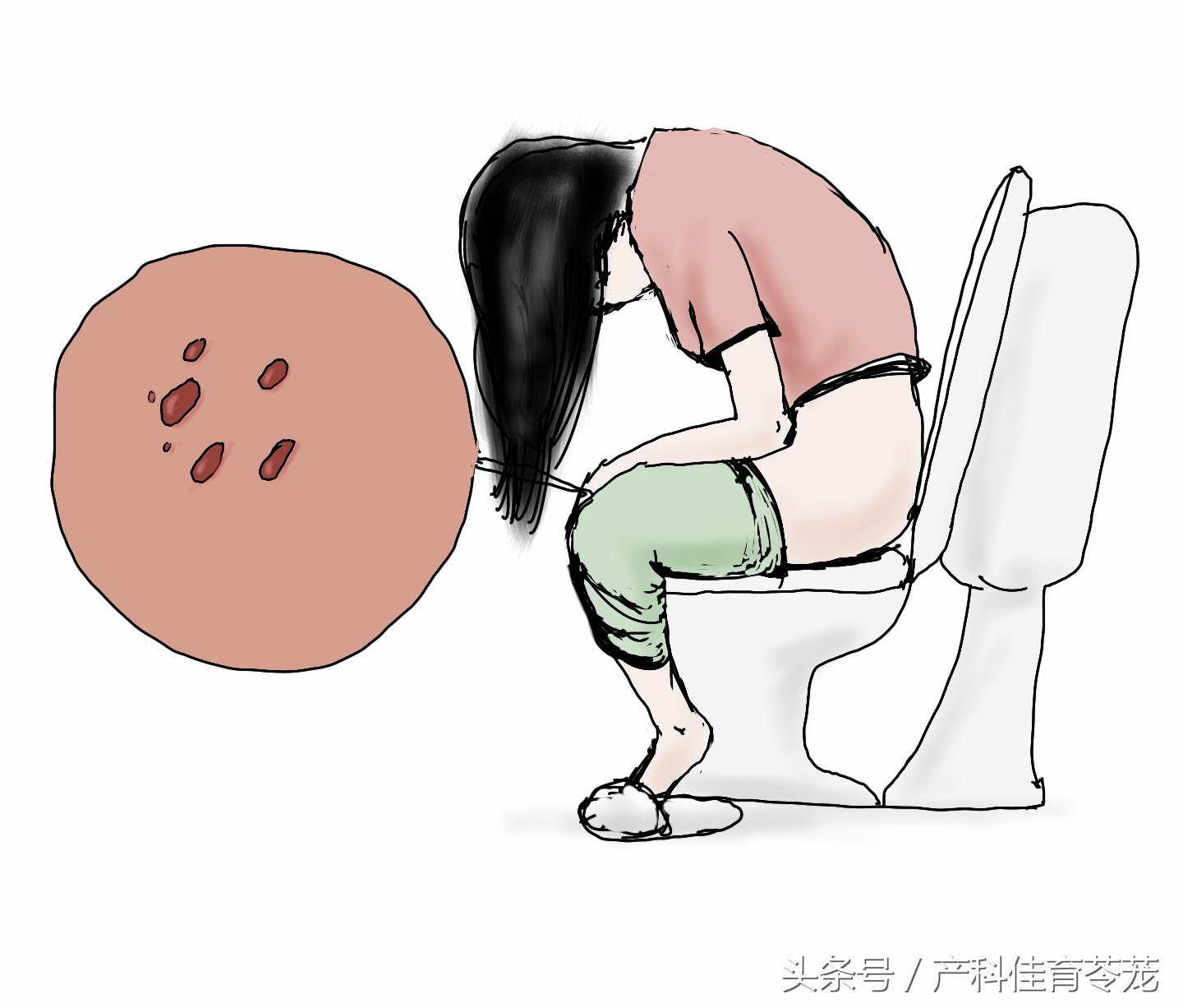 妊娠感染了hpv16,如果怀孕感染hpv怎么办