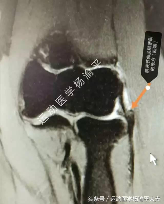 钓鱼和跑步冲突,钓鱼和打台球哪个好玩