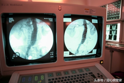 冠心病患者的问题,冠心病防治问答