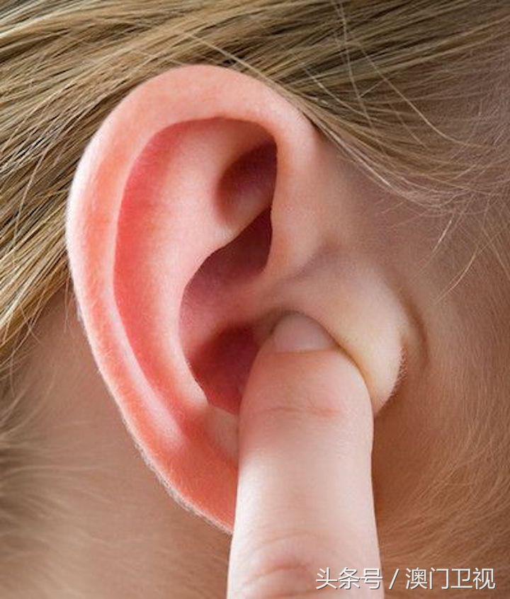 耳屎的颜色会随着时间发生变化吗,健康的耳屎是什么颜色