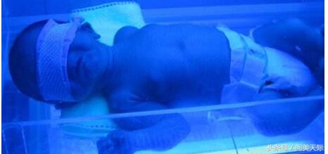 出生两天的宝宝就因黄疸被隔离，妈妈再见到孩子时忍不住大哭不止