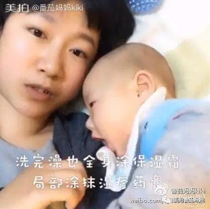 婴儿湿疹头垢洗了之后一直在出水,新生儿头垢和湿疹结痂的区别