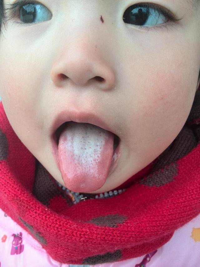 湿气重最好不要吃这些瓜果，只会加重湿气！