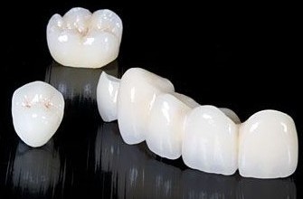 义齿怎么辨别真假,学会三招让你远离伪劣义齿