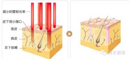 毛孔粗大收缩毛孔最有效的土方法,毛孔粗大怎么办教你快速收缩毛孔