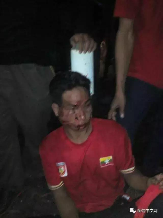 球迷被暴打后续,球迷被围殴后续