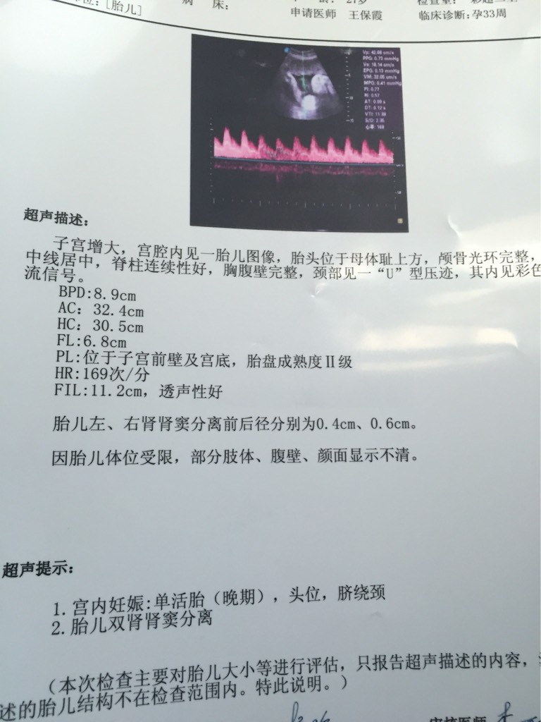 肾窦回声分离是什么意思,肾窦有点分离是什么意思