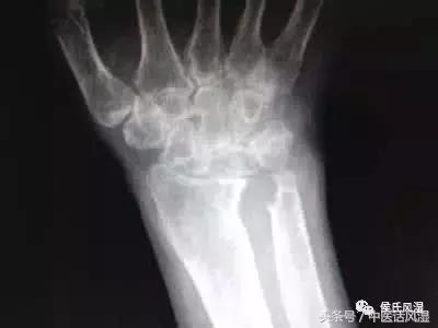 椋庢箍绫婚婀垮彲浠ョ棅鎰堝悧,鍗佸勾鐨勭被椋庢箍鑳界湅濂藉悧