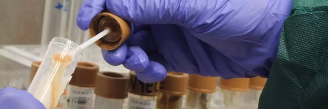 你狠心冲掉的便便,正成为许多肠胃病人的救星