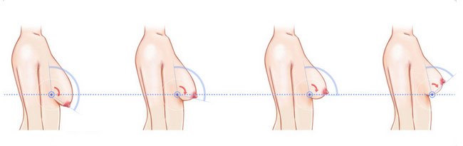 4招教你看出女人生过孩子,判断女人生过孩子最简单方法