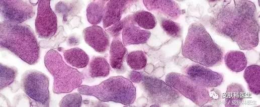 生殖支原体感染途径有哪些,男性生殖支原体感染治疗方案