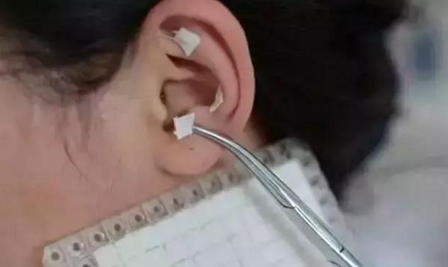 中医按摩手法能调理近视吗,中医对近视的调理方法