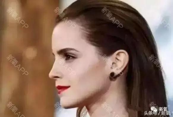 杨紫瘦了腿显得不纤细,杨紫变美之路脸怎么瘦的