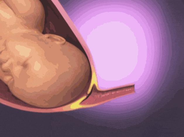 顺产到底有多疼看完你就知道了,顺产到底有多痛看完扎心了