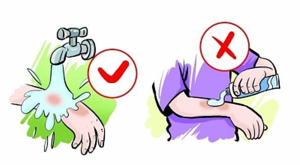 滚烫开水烫伤现场如何急救,手背被开水烫伤了怎么急救