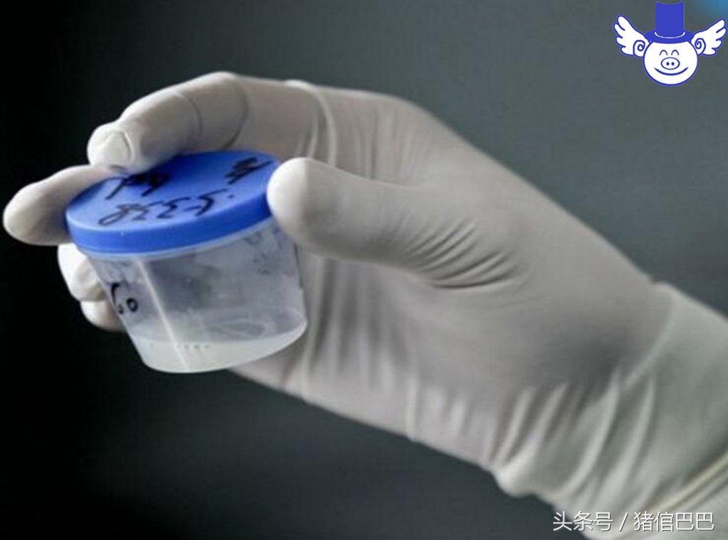 人工授精失败的原因解析，这四方面几乎涵盖了所有的问题！