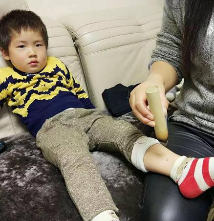 小孩艾灸的正确方法,小孩艾灸坏处