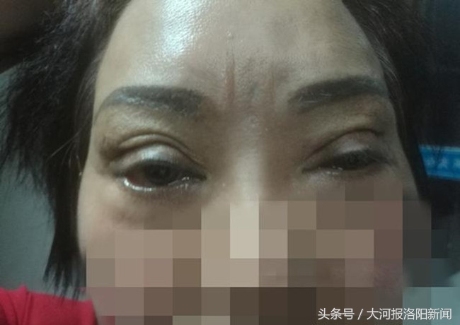 洛阳协和整形医院做双眼皮怎么样,协和医院双眼皮手术哪个大夫好