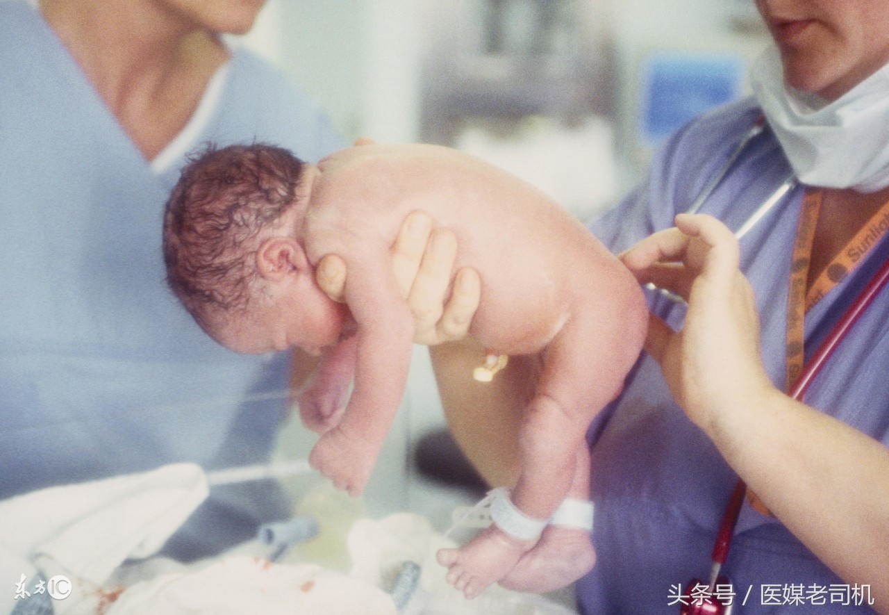 选择顺产和剖宫产,大多数人选择剖宫产还是顺产