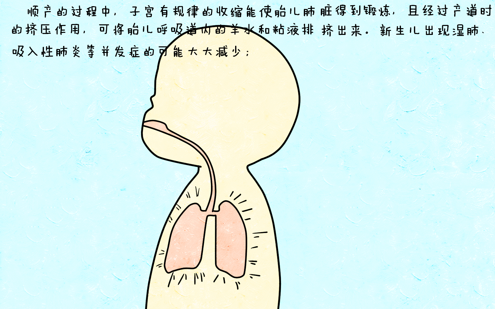 不顾身体状况一味抗拒剖腹产，坚持顺产有必要吗？