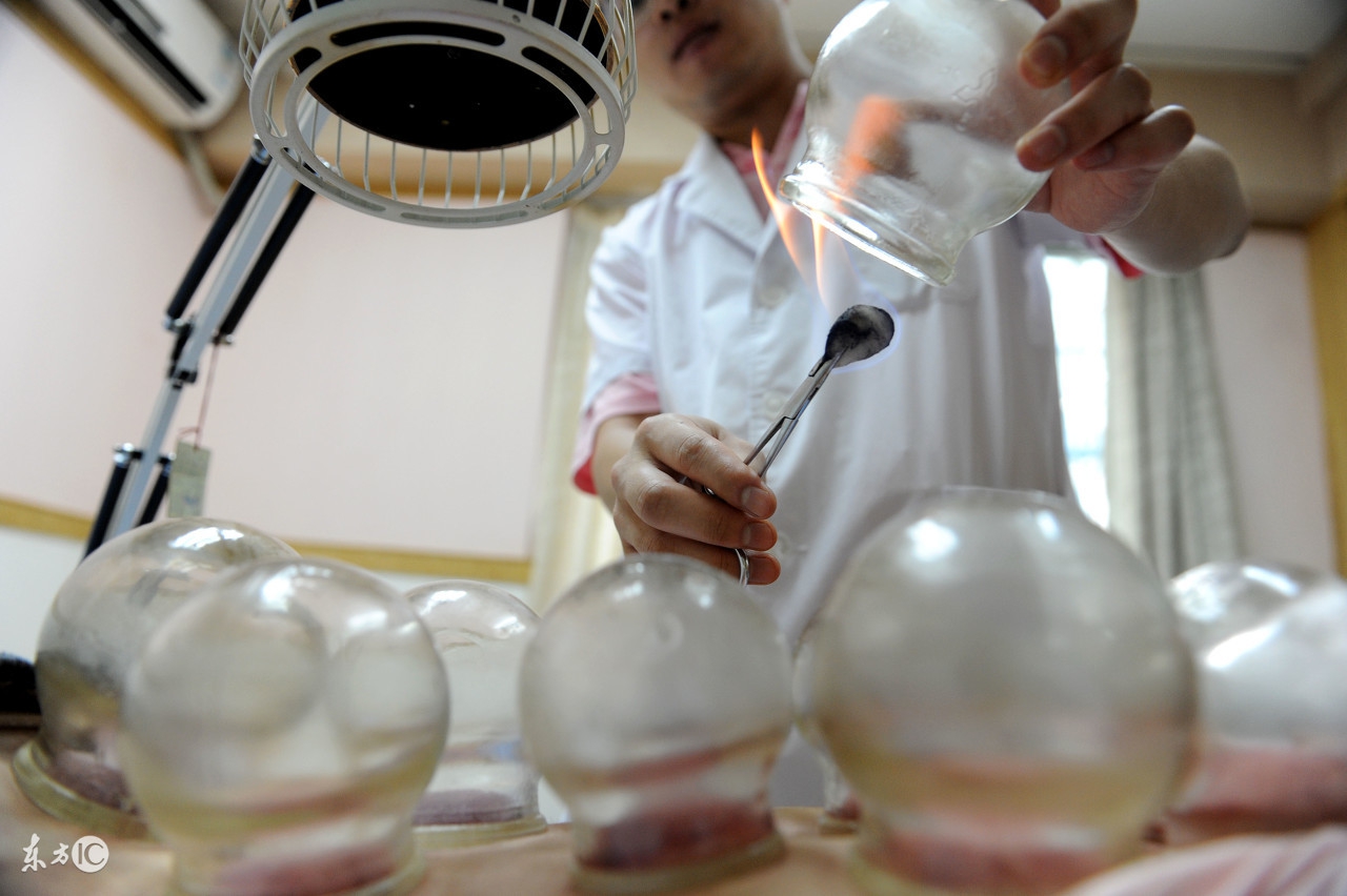 拔罐能祛除人体湿气吗,拔罐可以祛除体内湿气吗